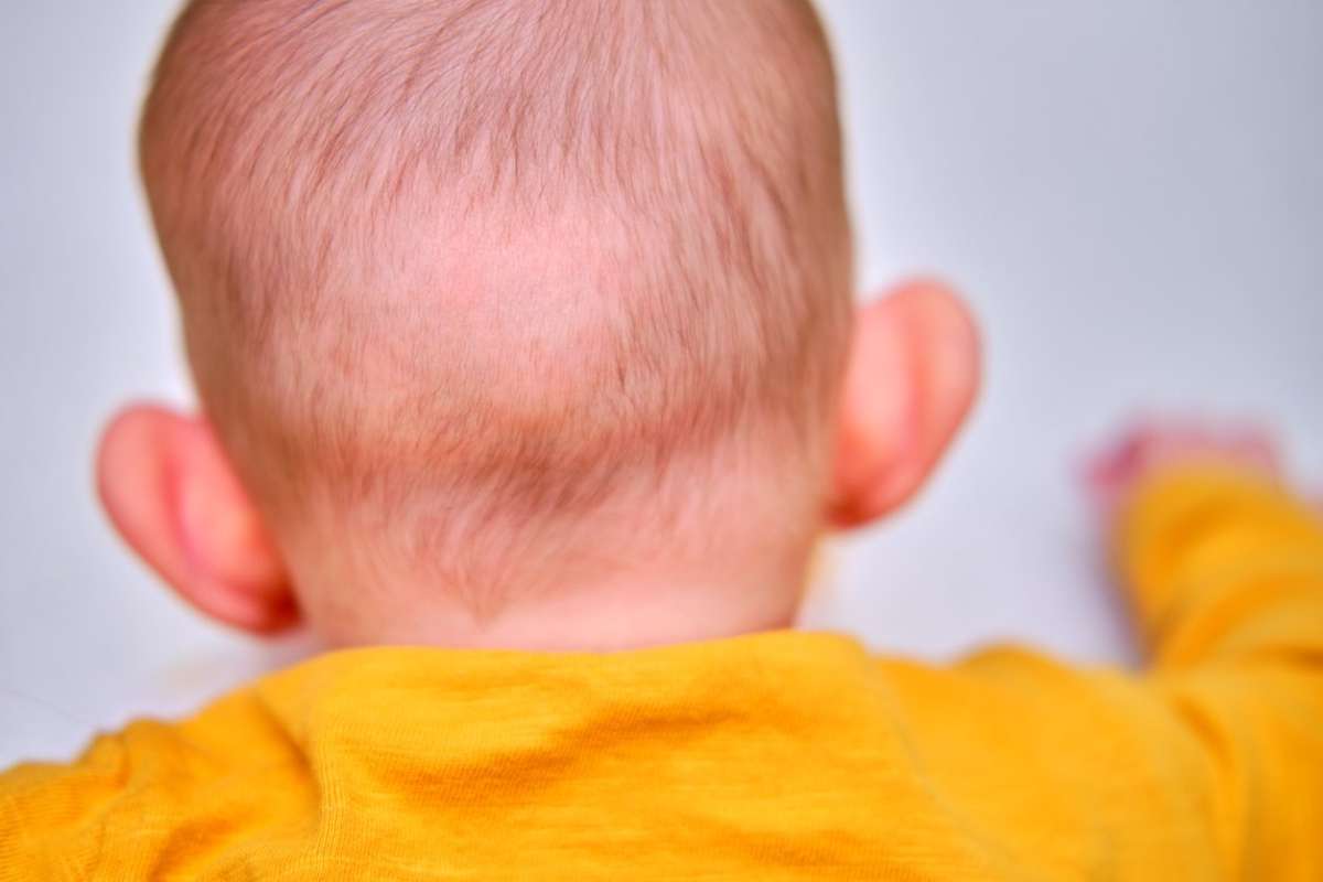 婴儿标准后脑勺图片（宝宝后脑勺）-幼儿百科-魔术铺